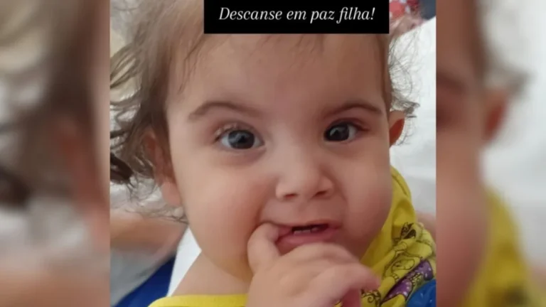 Morre uma das siamesas de São Paulo separadas em Goiás, diz pai