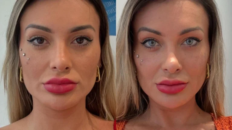 Andressa Urach reclama de dor após mudar cor dos olhos: “Arrependida”