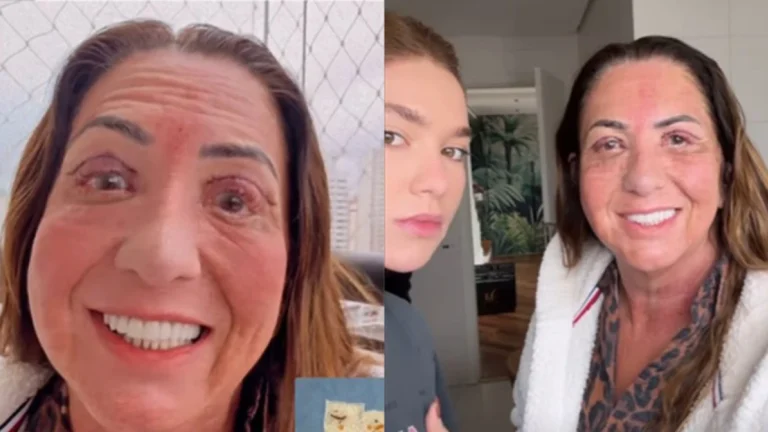 Mãe de Virginia faz cirurgia nos olhos e influenciadora choca web ao mostrar pele retirada: Nojo