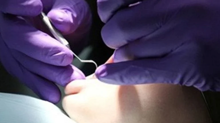Clínica odontológica é condenada por extrair dente errado de paciente no DF