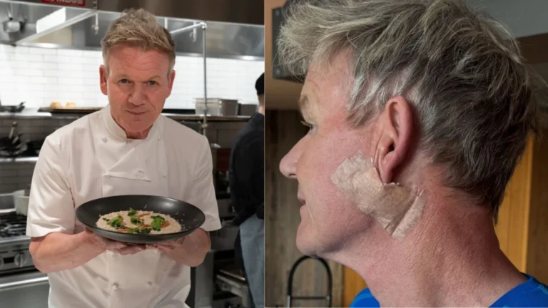 Gordon Ramsay passa por procedimento após diagnóstico de câncer de pele