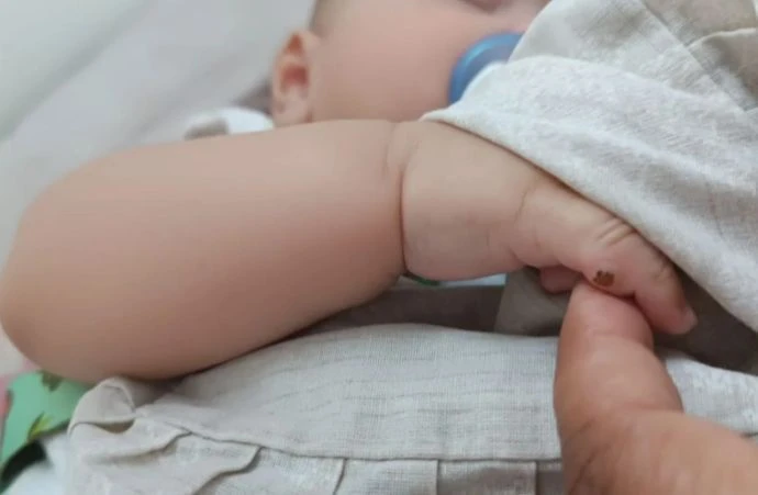 Bebê vai a hospital para cirurgia nos dedos e tem língua operada em SP