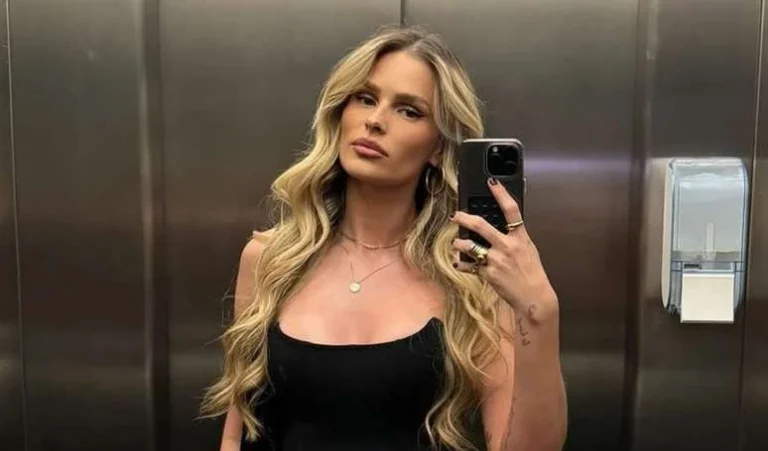 O que está por trás da beleza de Yasmin Brunet: modelo faz procedimento queridinho das famosas para deixar pele esticada e super natural