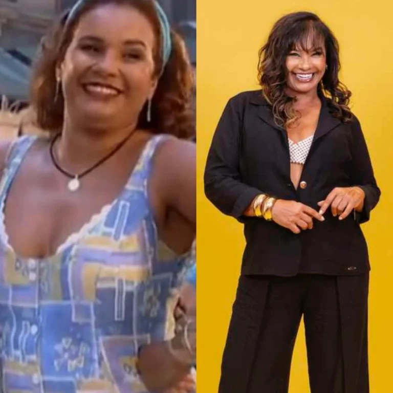 Solange Couto, do BBB 26, já fez cirurgia bariátrica e perdeu 40kg; relembre os procedimentos
