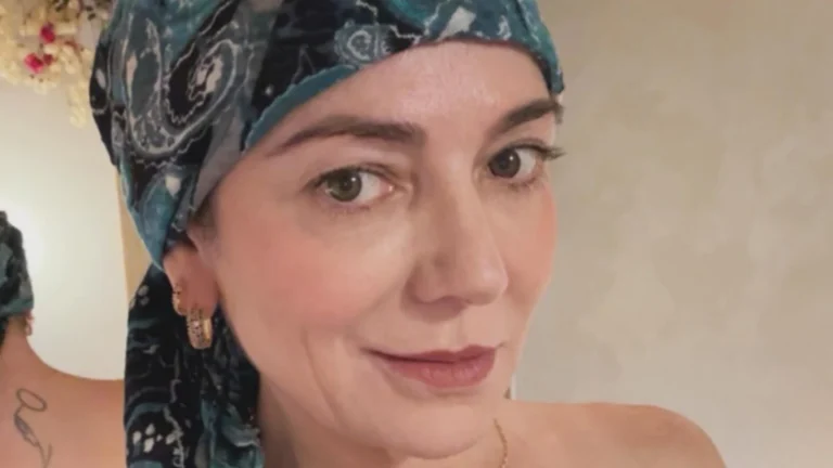 Karina, mãe de Lucas Lucco, revela diagnóstico de alopecia