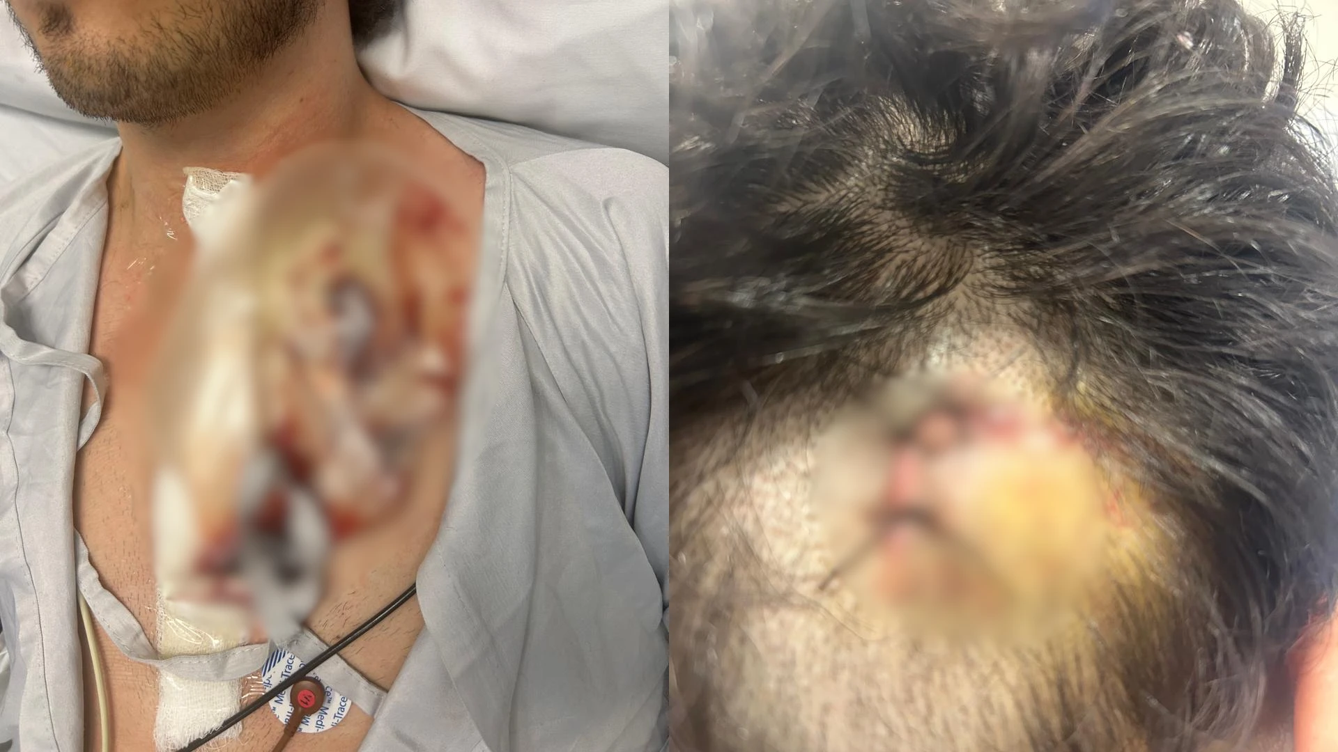 Médico e advogado sofrem ataque e são esfaqueados na Rua da Consolação (SP)