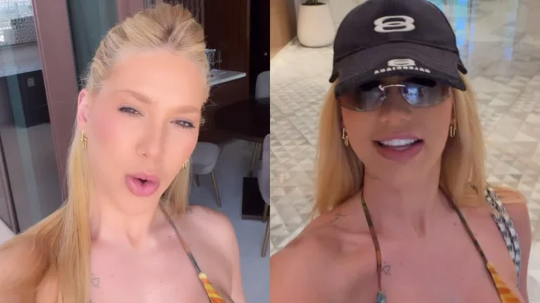 Virginia passa do ponto e fica “torrada” em Dubai por conta de bronzeamento