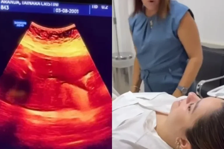 Maquiadora confunde gravidez de 8 meses com gases e viraliza. Veja vídeo