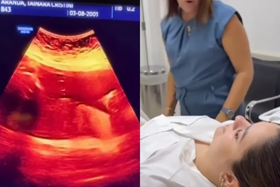 Maquiadora confunde gravidez de 8 meses com gases e viraliza. Veja vídeo
