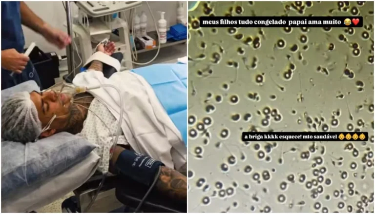 MC Cabelinho congela sêmen 3 anos após vasectomia