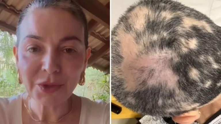 Mãe de Lucas Lucco mostra recaída de diagnóstico severo: ‘Fiquei mais triste agora’