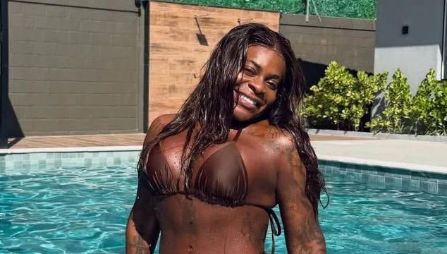 Jojo Todynho mostra cicatriz após retirar excesso de pele das axilas