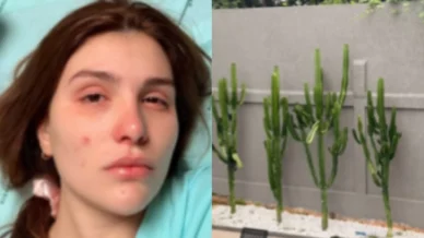 Influenciadora sofre lesão nos olhos após podar cacto: 