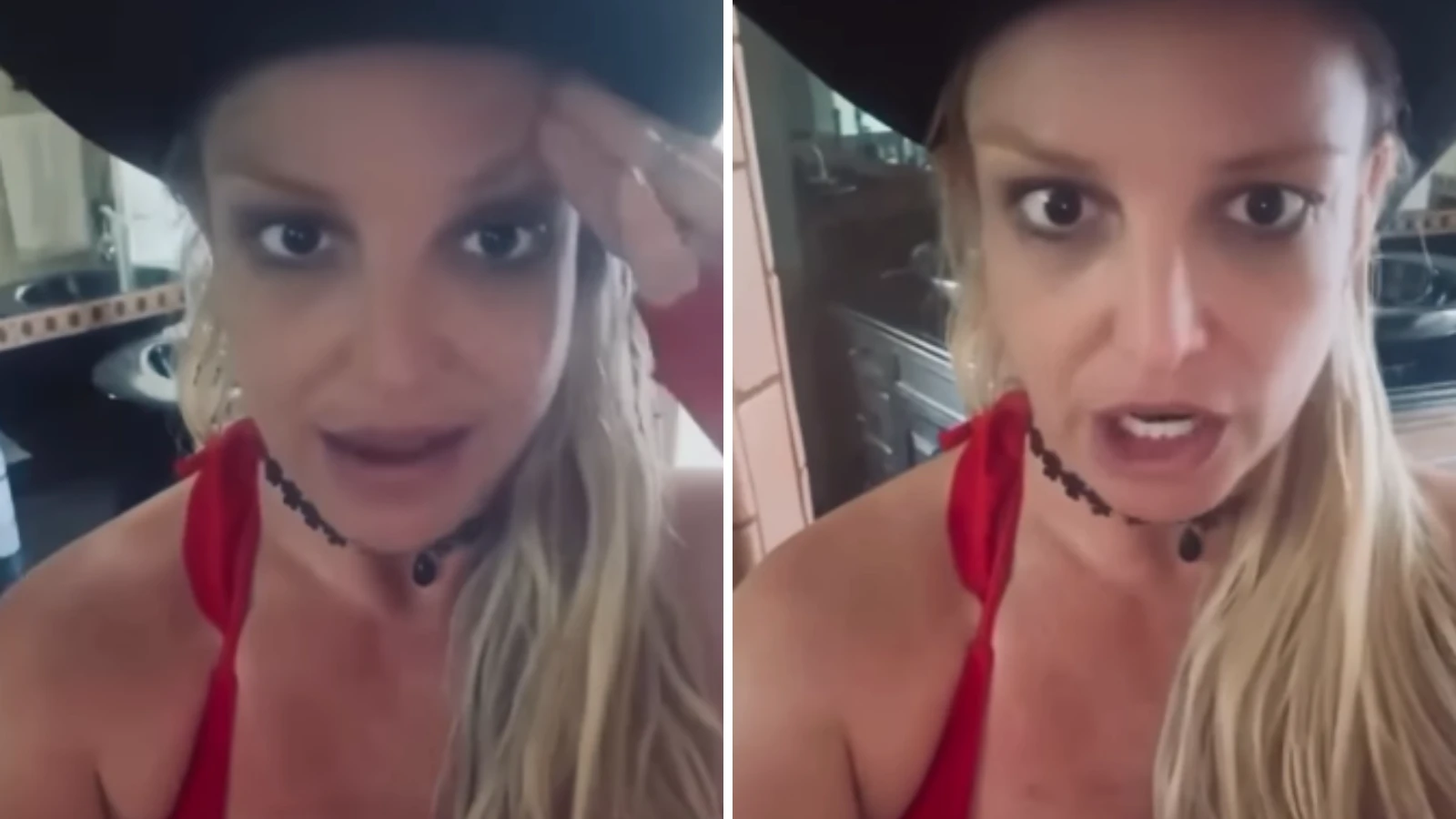 Britney Spears mostra procedimento estético e desabafa: 